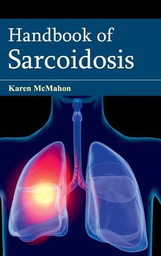 Cover image for Handbook of Sarcoidosis