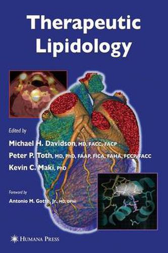 Cover image for Therapeutic Lipidology