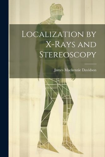 Localization by X-Rays and Stereoscopy