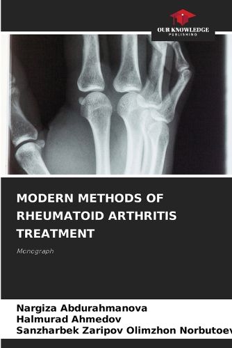 Cover image for Modern Methods of Rheumatoid Arthritis Treatment