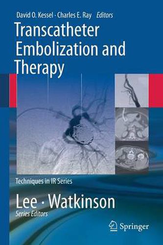 Cover image for Transcatheter Embolization and Therapy