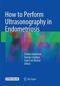 Cover image for How to Perform Ultrasonography in Endometriosis