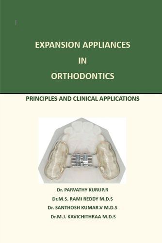Cover image for Expansion Appliance in Orthodontics