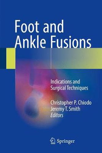 Cover image for Foot and Ankle Fusions: Indications and Surgical Techniques