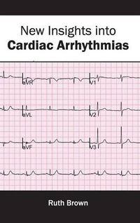 Cover image for New Insights Into Cardiac Arrhythmias