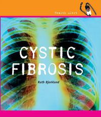 Cover image for Cystic Fibrosis