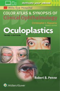 Cover image for Oculoplastics