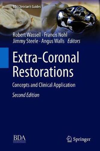 Cover image for Extra-Coronal Restorations: Concepts and Clinical Application