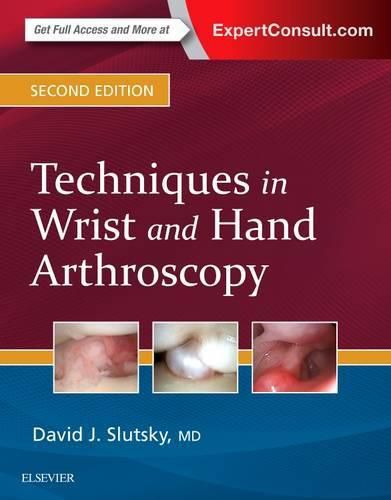 Cover image for Techniques in Wrist and Hand Arthroscopy