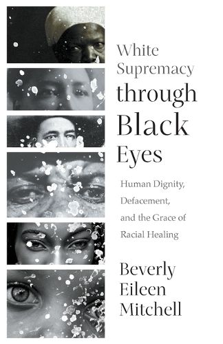 Cover image for White Supremacy through Black Eyes