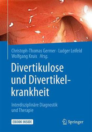 Cover image for Divertikulose und Divertikelkrankheit: Interdisziplinare Diagnostik und Therapie