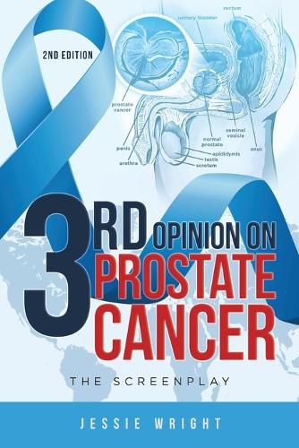 Cover image for 3rd Opinion on Prostate Cancer: The Screenplay