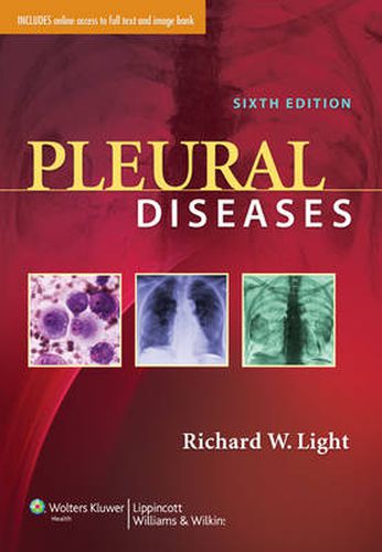 Cover image for Pleural Diseases