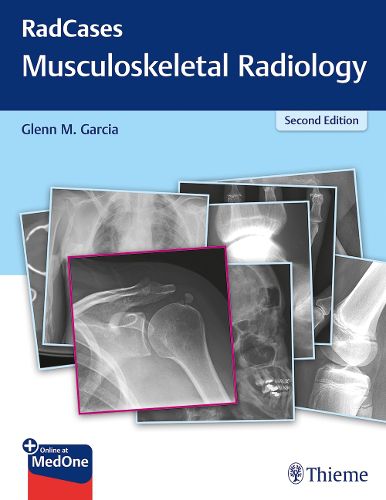 Cover image for RadCases Q&A Musculoskeletal Radiology