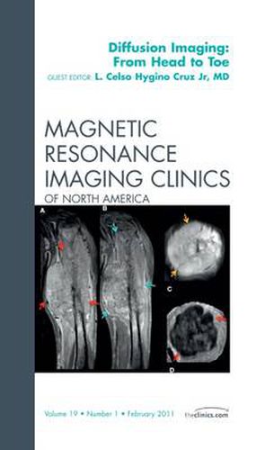 Cover image for Clinical Applications of Diffusion Imaging: from Head to Toe, An Issue of Magnetic Resonance Imaging Clinics