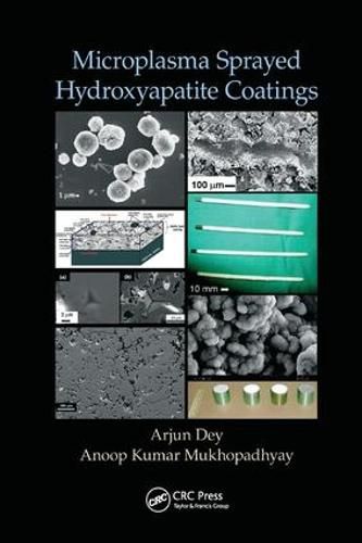 Cover image for Microplasma Sprayed Hydroxyapatite Coatings