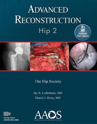Cover image for Advanced Reconstruction: Hip 2: Print + Ebook with Multimedia