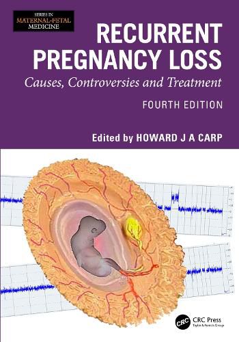 Cover image for Recurrent Pregnancy Loss
