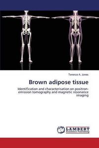 Cover image for Brown adipose tissue