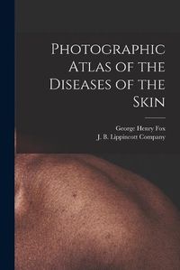 Cover image for Photographic Atlas of the Diseases of the Skin