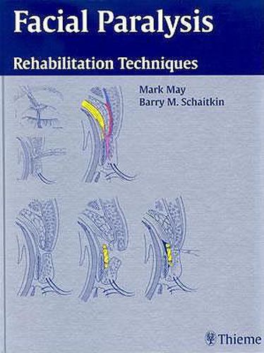 Cover image for Facial Paralysis: Rehabilitation Techniques