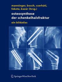 Cover image for Osteosynthese der Schenkelhalsfraktur: Ein Bildatlas