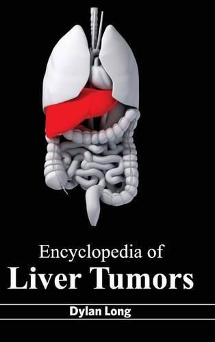 Cover image for Encyclopedia of Liver Tumors