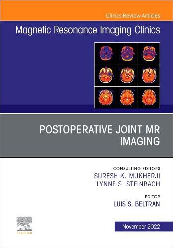 Cover image for Postoperative Joint MR Imaging, An Issue of Magnetic Resonance Imaging Clinics of North America: Volume 30-4