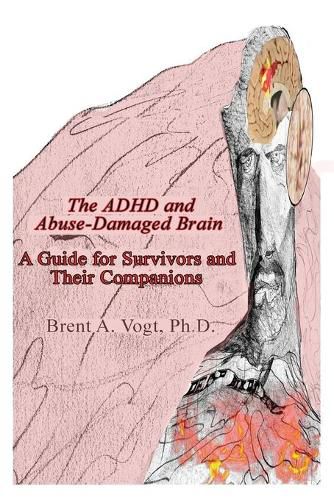 Cover image for The ADHD and Abuse-Damaged Brain: A Guide for Survivors and Their Companions