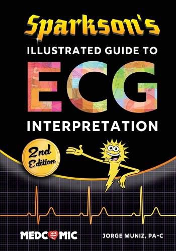 Cover image for Sparkson's Illustrated Guide to ECG Interpretation, 2nd Edition