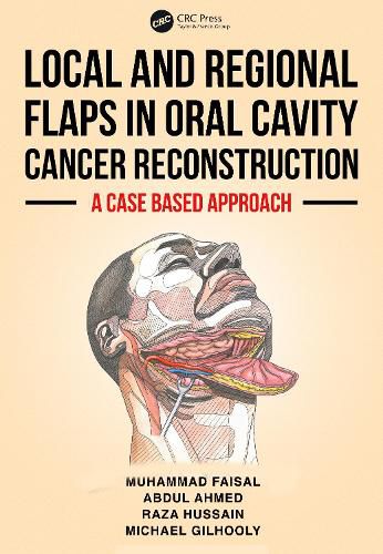Cover image for Local and Regional Flaps in Oral Cavity Cancer Reconstruction