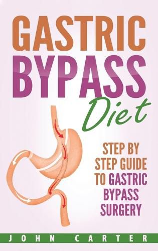Cover image for Gastric Bypass Diet: Step By Step Guide to Gastric Bypass Surgery
