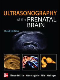 Cover image for Ultrasonography of the Prenatal Brain, Third Edition