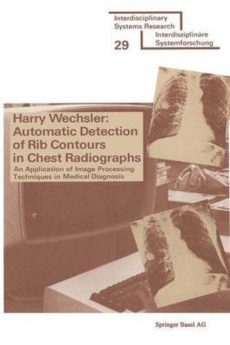 Cover image for Automatic Detection of Rib Contours in Chest Radiographs: An Application of Image Processing Techniques in Medical Diagnosis