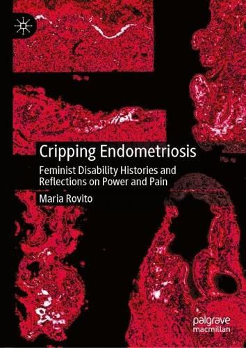 Cover image for Cripping Endometriosis