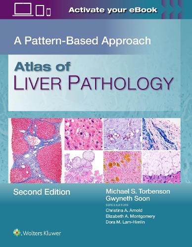 Cover image for Atlas of Liver Pathology