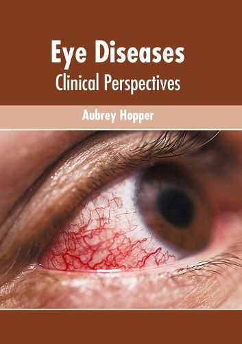 Cover image for Eye Diseases: Clinical Perspectives