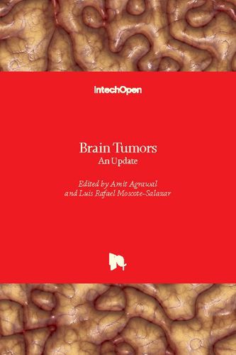 Cover image for Brain Tumors: An Update