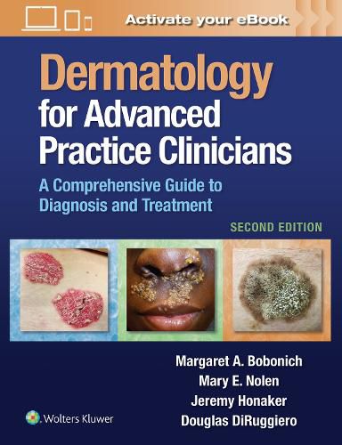 Cover image for Dermatology for Advanced Practice Clinicians: A Practical Approach to Diagnosis and Management