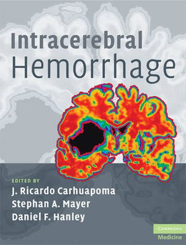 Cover image for Intracerebral Hemorrhage