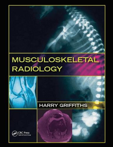 Cover image for Musculoskeletal Radiology