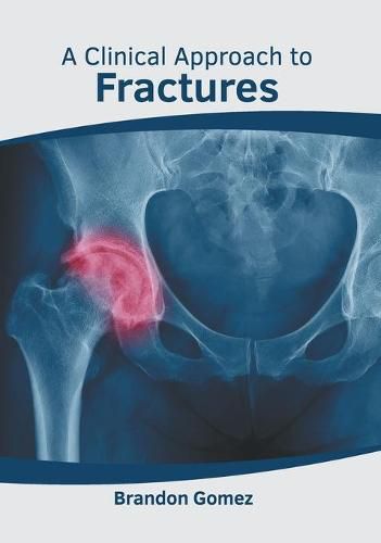 Cover image for A Clinical Approach to Fractures