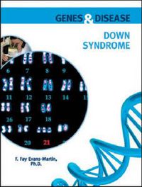 Cover image for Down Syndrome