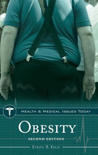 Cover image for Obesity, 2nd Edition