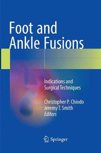 Cover image for Foot and Ankle Fusions: Indications and Surgical Techniques