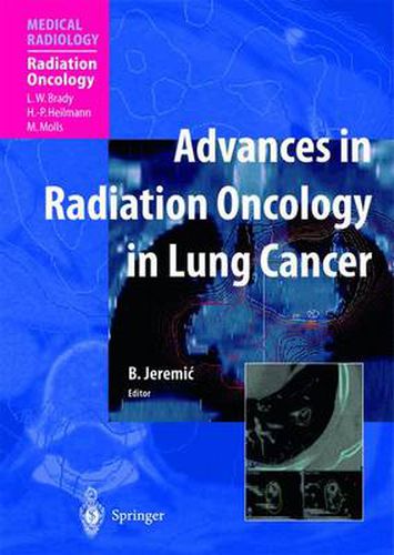 Cover image for Advances in Radiation Oncology in Lung Cancer