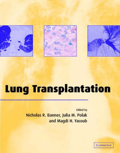 Cover image for Lung Transplantation