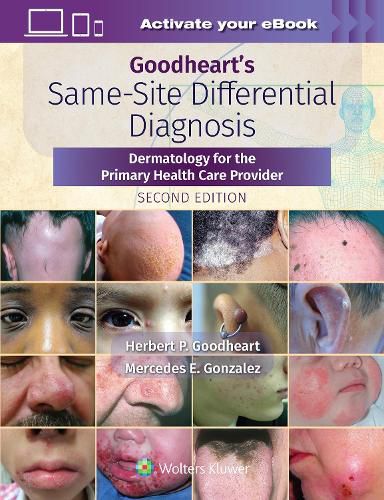 Cover image for Goodheart's Same-Site Differential Diagnosis: Dermatology for the Primary Health Care Provider