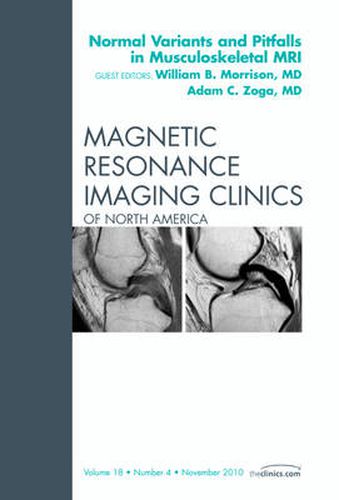 Normal Variants and Pitfalls in Musculoskeletal MRI, An Issue of Magnetic Resonance Imaging Clinics