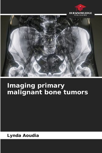 Cover image for Imaging primary malignant bone tumors